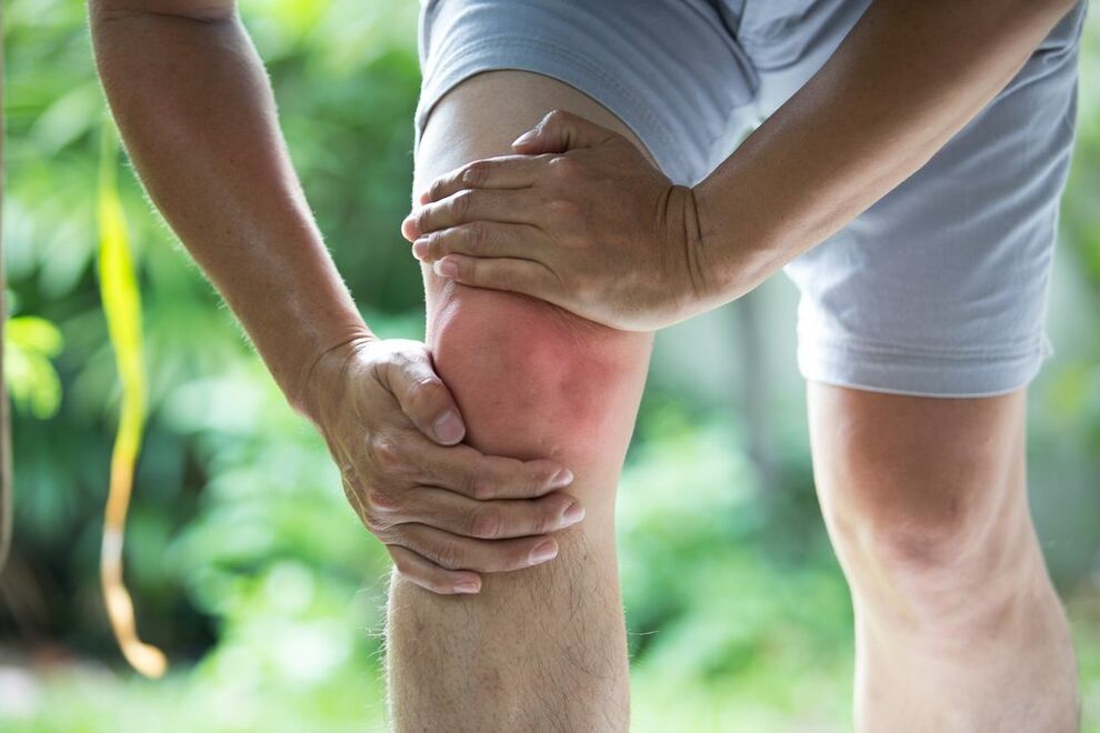 Gelenkschmerzen sind die auffälligste Manifestation von Arthrose und Arthritis. 