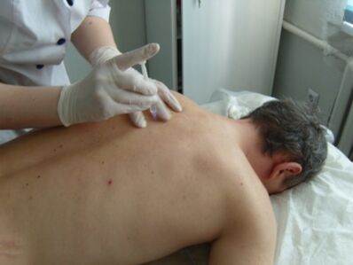 Intraartikuläre Injektionen von Chondroprotektoren bei thorakaler Osteochondrose